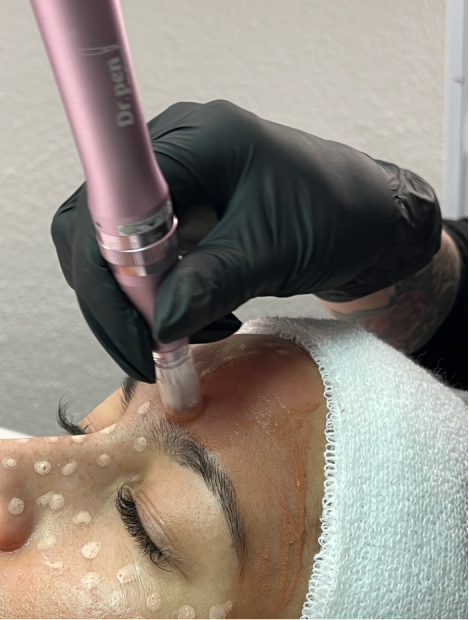CURSO DERMAPEN / MICRONEEDLING BB GLOW