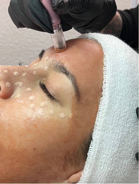 CURSO DERMAPEN / MICRONEEDLING BB GLOW
