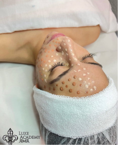 CURSO DERMAPEN / MICRONEEDLING BB GLOW