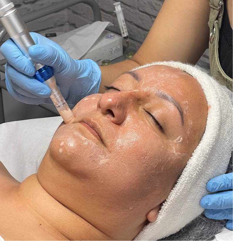 CURSO DERMAPEN / MICRONEEDLING BB GLOW