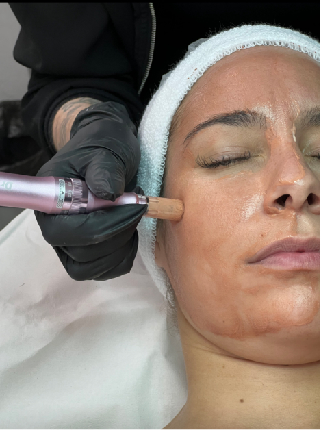 CURSO DERMAPEN / MICRONEEDLING BB GLOW