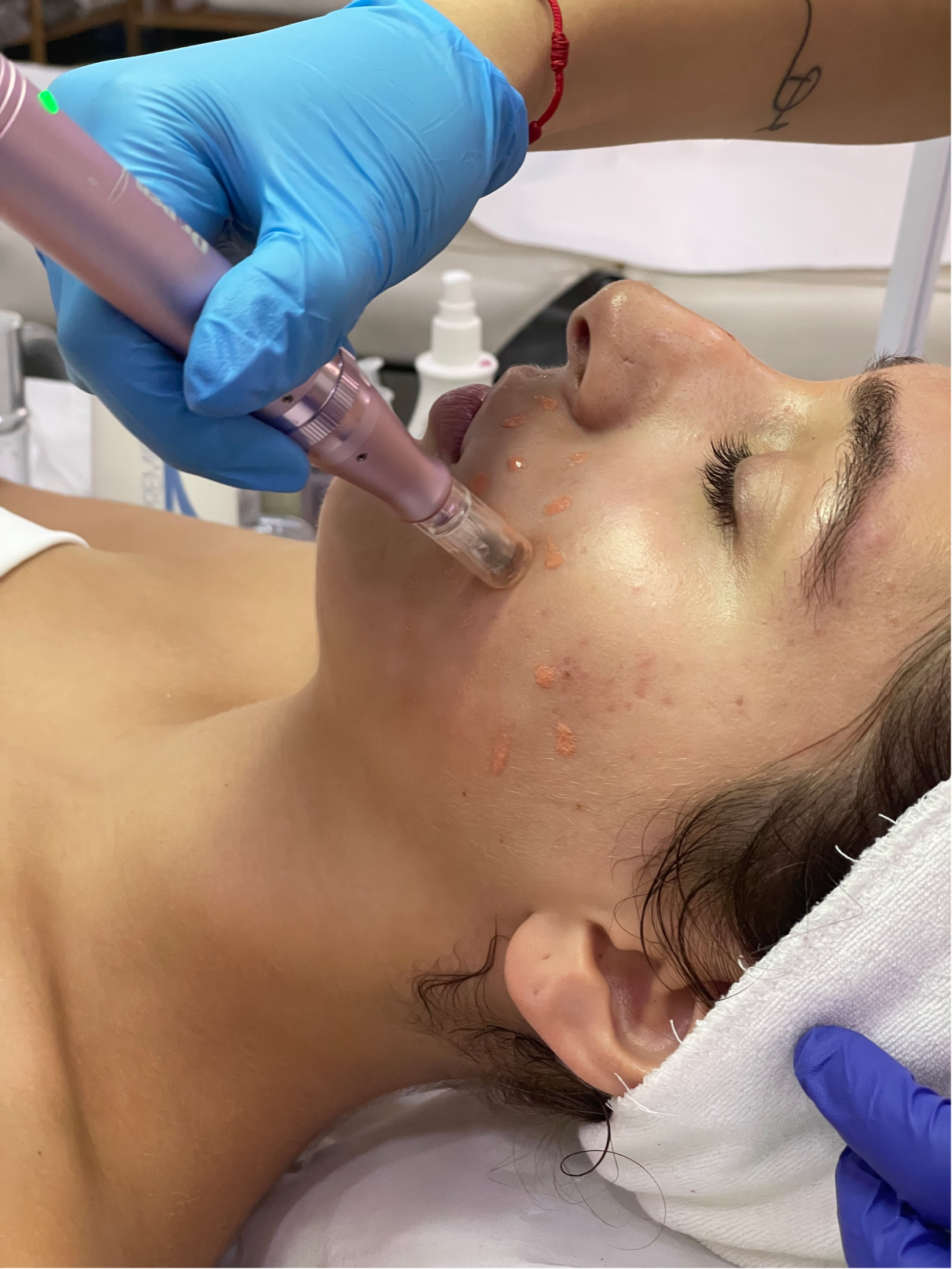 CURSO DERMAPEN / MICRONEEDLING BB GLOW